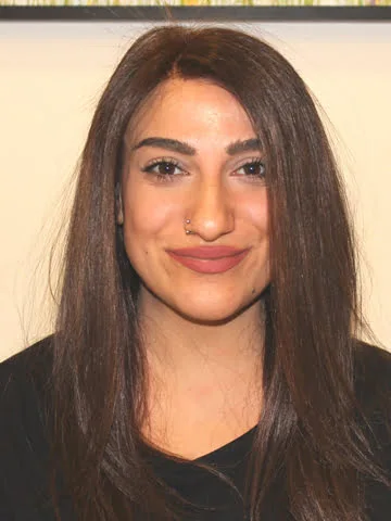 Hair Hotel kadın önce sonra